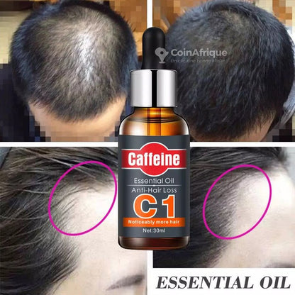 Huile Anti-Chute C1 – ✨ Retrouvez vos cheveux. Retrouvez votre assurance