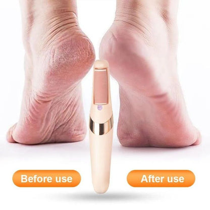 Râpe électrique pour les pieds – Dites adieu aux talons secs et fissurés !
