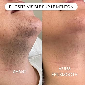 Epilateur facial -Dites adieu aux poils du visage en quelques secondes !