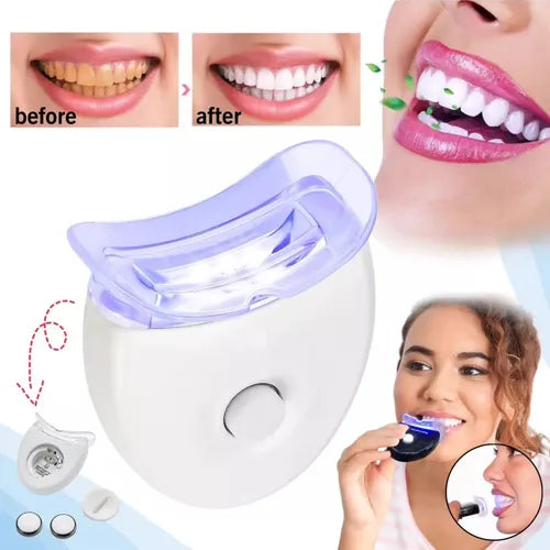 KIT BLANCHIMENT DENTAIRE LED – NE LAISSE PLUS TES DENTS GÂCHER TON SOURIRE