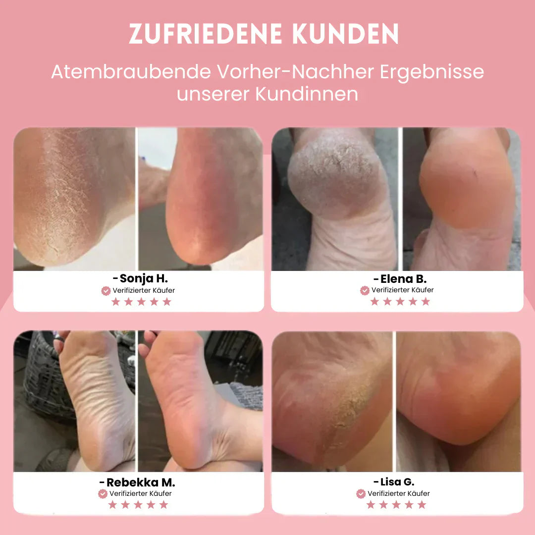 🌸 Ponceuse Électrique Skin&Shape – Fini la honte de montrer vos pieds !