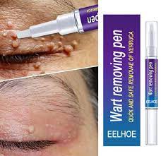 ✨ Stylo Anti-Verrues – Retrouver une peau nette et la confiance de sourire !