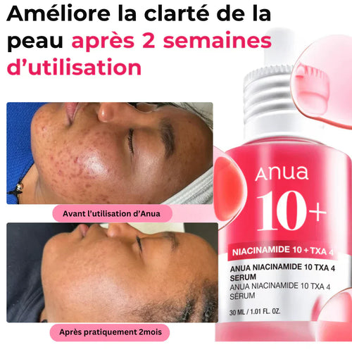 ANUA NIACINAMIDE 10% + TXA 4%-POUR UNE PEAU NETTE ET SANS IMPERFECTIONS