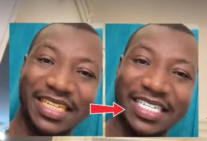 KIT BLANCHIMENT DENTAIRE LED – NE LAISSE PLUS TES DENTS GÂCHER TON SOURIRE