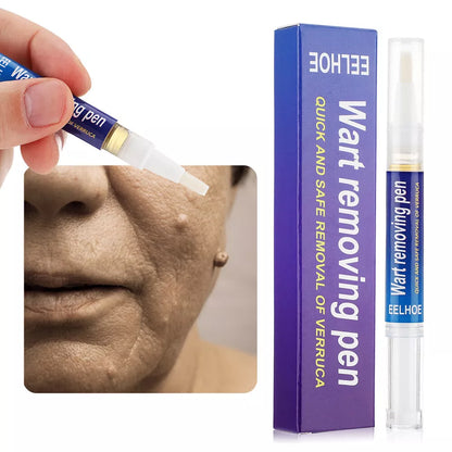 ✨ Stylo Anti-Verrues – Retrouver une peau nette et la confiance de sourire !