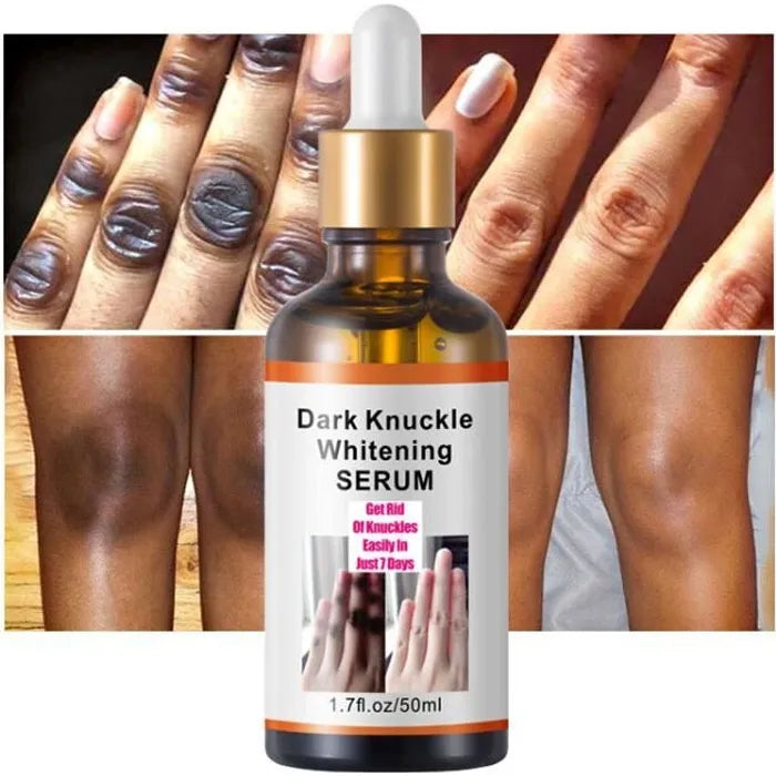 🔥 Sérum Anti-Taches  – Élimine les zones sombres rapidement !