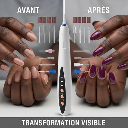 Transformation visible
